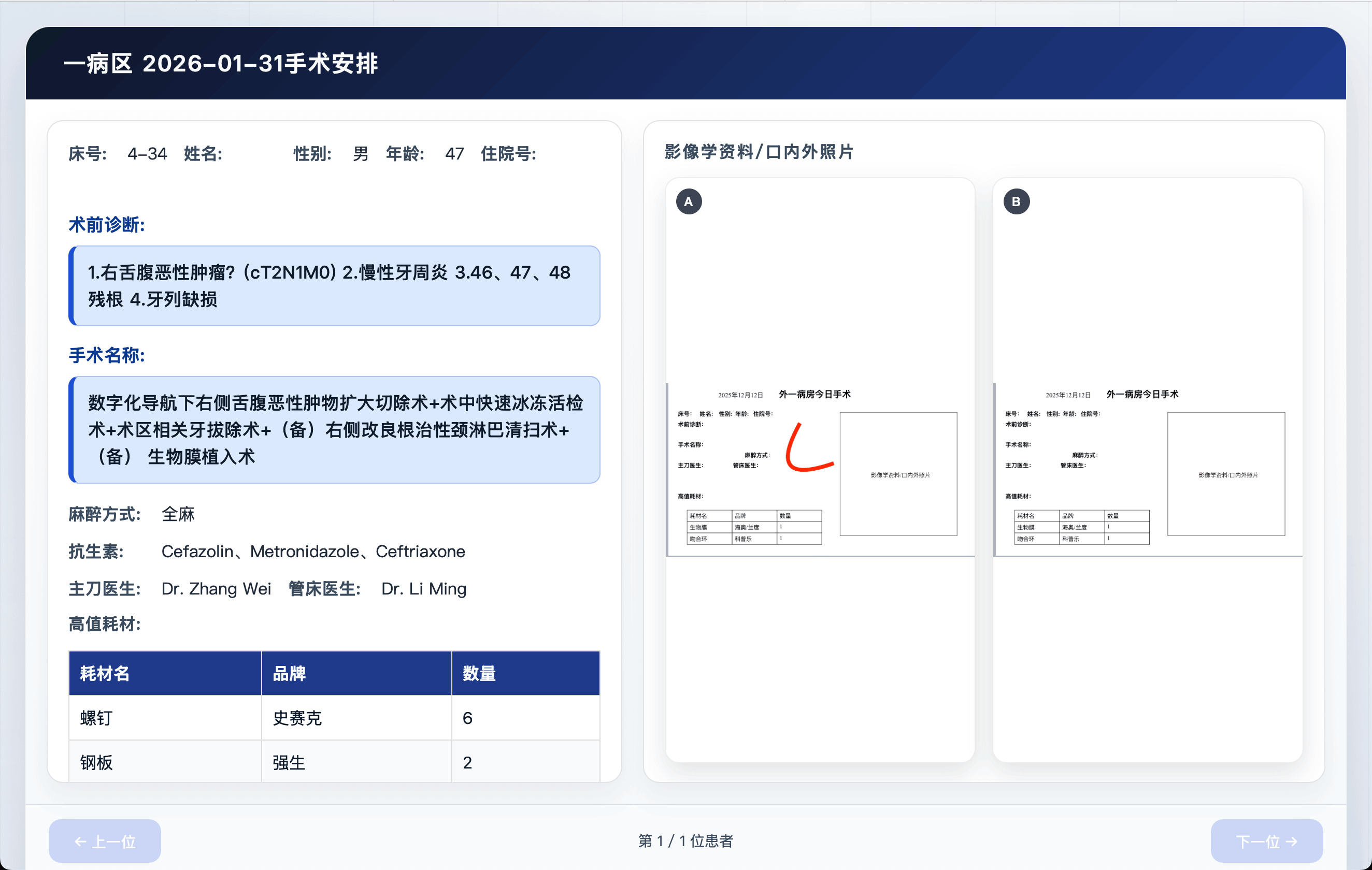 患者手术计划展示界面